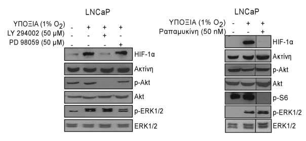 αναμενόμενο, μείωσε τα επίπεδα της φωσφορυλιωμένης Akt και προκάλεσε σημαντική μείωση στα επίπεδα έκφρασης του HIF-1α σε κύτταρα LNCaP και PC3.