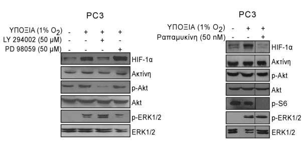 Εικόνα 68: Επίδραση των μονοπατιών PI3K/Akt/mTOR και ERK 1/2 στην έκφραση του HIF-1α σε κύτταρα LnCAP και PC3.