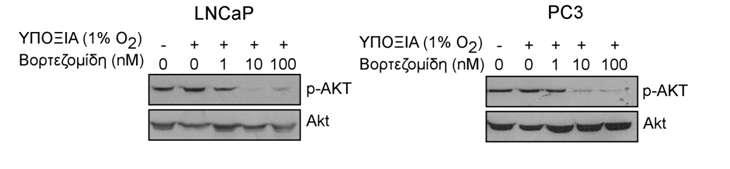 Εικόνα 72: Επίδραση του αναστολέα πρωτεασώματος βορτεζομίδη στο σηματοδοτικό μονοπάτι PI3K/Akt σε κύτταρα LNCaP και PC3.