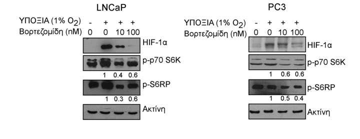 απουσία ή παρουσία της βορτεζομίδης (1, 10 και 100 nm). Τα αποτελέσματα είναι αντιπροσωπευτικά τριών ανεξάρτητων πειραμάτων. 3.4.1.5.