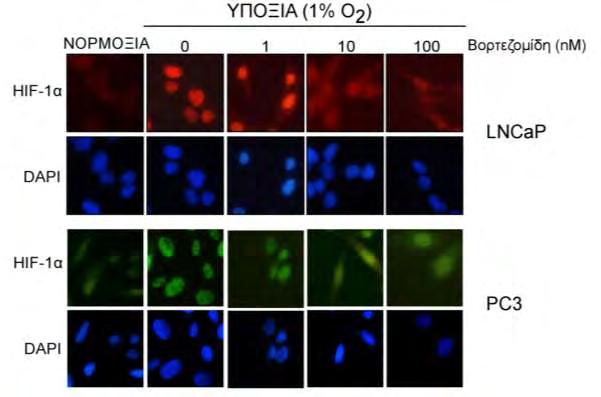 3.4.1.6. Μελέτη της επίδρασης του αναστολέα πρωτεασώματος βορτεζομίδη στον υποκυτταρικό εντοπισμό του HIF-1α σε κύτταρα LNCaP και PC3.