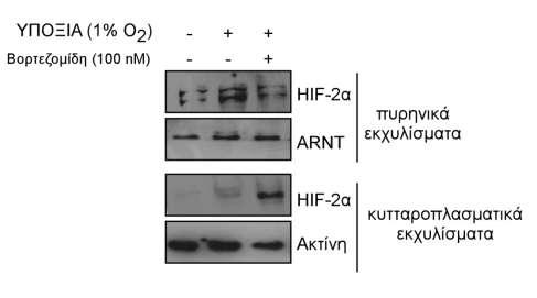 Α Β Εικόνα 81: Επίδραση του αναστολέα πρωτεασώματος βορτεζομίδη στον υποκυτταρικό εντοπισμό του HIF-2α σε κύτταρα Huh7. A.