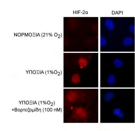 Ανοσοφθορισμό κυττάρων Huh7 που επωάστηκαν σε υποξία (1% Ο 2 ) παρουσία ή απουσία της βορτεζομίδης (100 nm) για 16 ώρες.