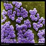 1.2 Staphylococcus aureus(χρυσίζων σταφυλόκοκκος) Εικ.14 Ο S.aureus ανήκει στο γένος των βακτηρίων που είναι θετικοί κατά Gram κόκκοι.