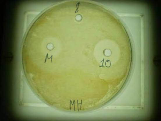 δείγματα 2,4 και 11 και τέλος το δείγμα 5 το οποίο παρουσιάζει την μικρότερη αντιμικροβιακή δράση σε σχέση με τα υπόλοιπα δείγματα μελιού και το μέλι Manuka 25+.