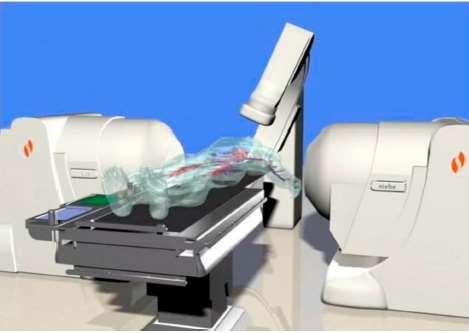 CONS of manual procedures: Catheter mobility (limited torque transmission) Catheter orientation Catheter stability