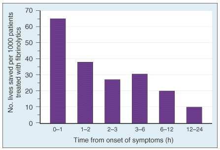 Lives saved per 1000 treated patients 80 60 40 20 0 0 Thrombolysis: the golden hour Absolute reduction in 35 day mortality per 1000