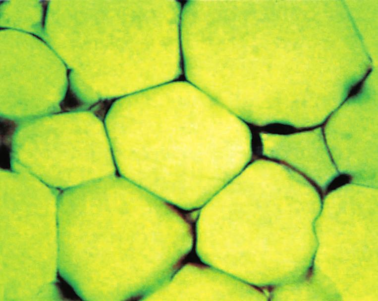 οστά. Ο λιπώδης ιστός είναι ένας ειδικός τύπος χαλαρού συνδετικού ιστού, του οποίου τα κύτταρα (λιποκύτταρα) αποθηκεύουν λίπος (εικ.1.6). λιποκύτταρο εικ. 1.