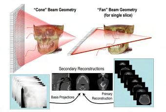 CBCT για χρήση του στην ART Η ακρίβεια της χορήγησης της δόσης κατά τη διάρκεια μιας θεραπευτικής πράξης με τη χρήση του Planning CT (PCT), μπορεί να περιοριστεί λόγω αλλαγών στην ανατομία του