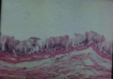+ 15. Υαλοειδής χόνδρος (τραχεία) Α Ψευδοπολύστιβο κροσσωτό επιθήλιο (τραχεία) Χαλαρός συνδετικός ιστός με ελαστικές ίνες από κάτω