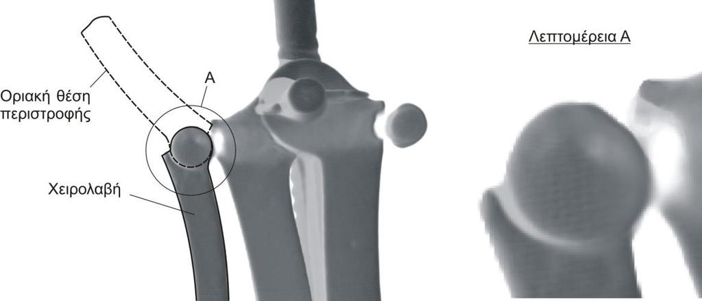 Σχήμα 21: Αξονική τομογραφία του κολποσκοπίου, με ελλείπουσα την δεξιά χειρολαβή. Η δεξιά λαβή δεν ανευρέθηκε κατά τις ανασκαφές.
