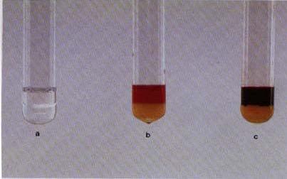 Трихлоро соединенија (chloral hydrat, chloroform, trichloroethylene) - Fujiwara тест Во три епрувети, слепа проба, примерок и раствор на трихлорооцетна киселина се додава по 1 ml NaOH и 1 ml пиридин,