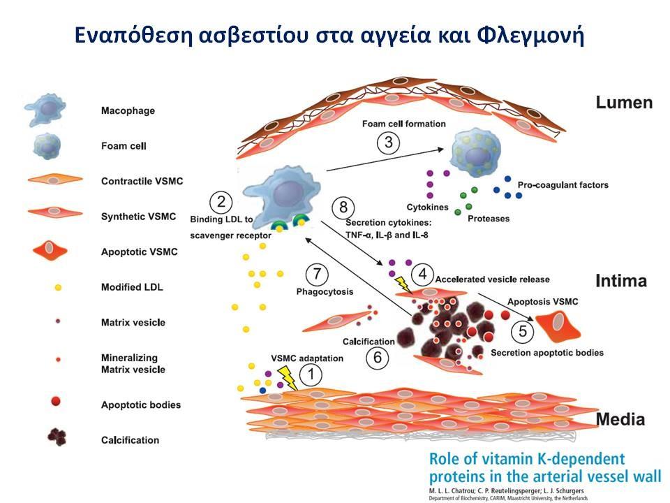 Ασβέστιο Βιταμίνη K και βιταμίνη D Ένας κεντρικός παράγοντας στη δημιουργία της αρτηριοσκλήρυνσης είναι η εναπόθεση ασβεστίου στο αγγειακό τοίχωμα.