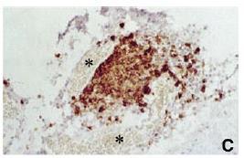 Semin Neurol 2008;28:29-45; 2. Cheng Z, et al. Drug Metab Disposition 2010;38:1355 61, Sospedra M et al. Ann Rev Immunol 2005;23:683-747. 2. Serafini, B. Brain Pathol 2004;14:164-174.