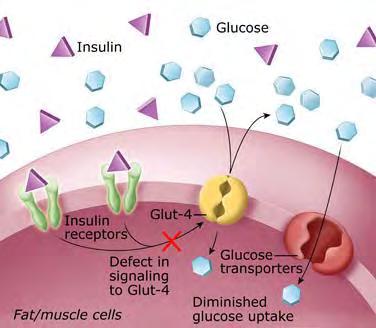ευαισθησίας των κυττάρων σε αυτή (ινσουλινοαντοχή), και συνεπακόλουθη μη επαρκή δράση της ινσουλίνης (Εικόνα 4) ( Stryer, L., 2005; Zimmet, P. Et al., 2001; Alberti, K.G.et al., 2001; Devlin, T.M.