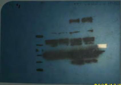 Εικόνα 11: Φωογραφία του film μετά απόwesternblotting Γ) Επαγωγή υπερέκφρασης PARN(1-523) και μελέτη κινητικών παραμέτρων Μετά την O/N καλλιέργεια BL21Gold κυττάρων με την επιθυμητή μετάλλαξη (PARN