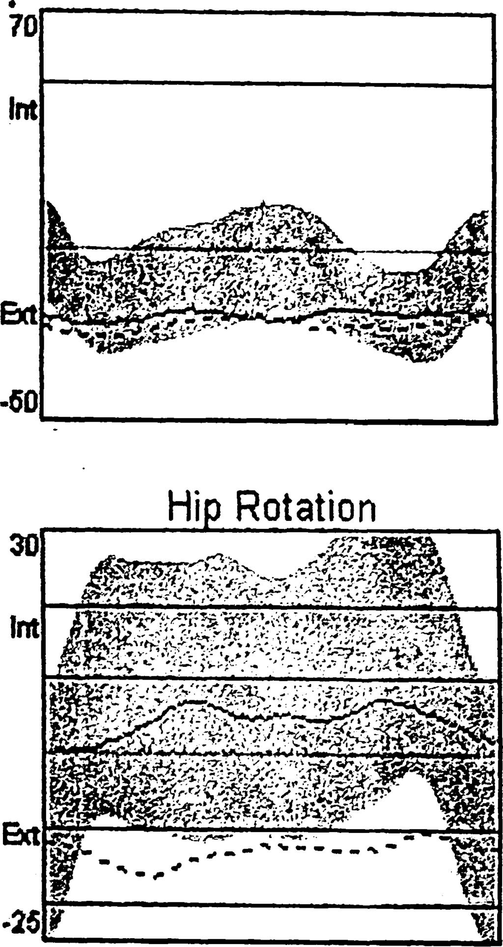 30 - Int Knee Rotation Ext i s m Περιστατικό 3: