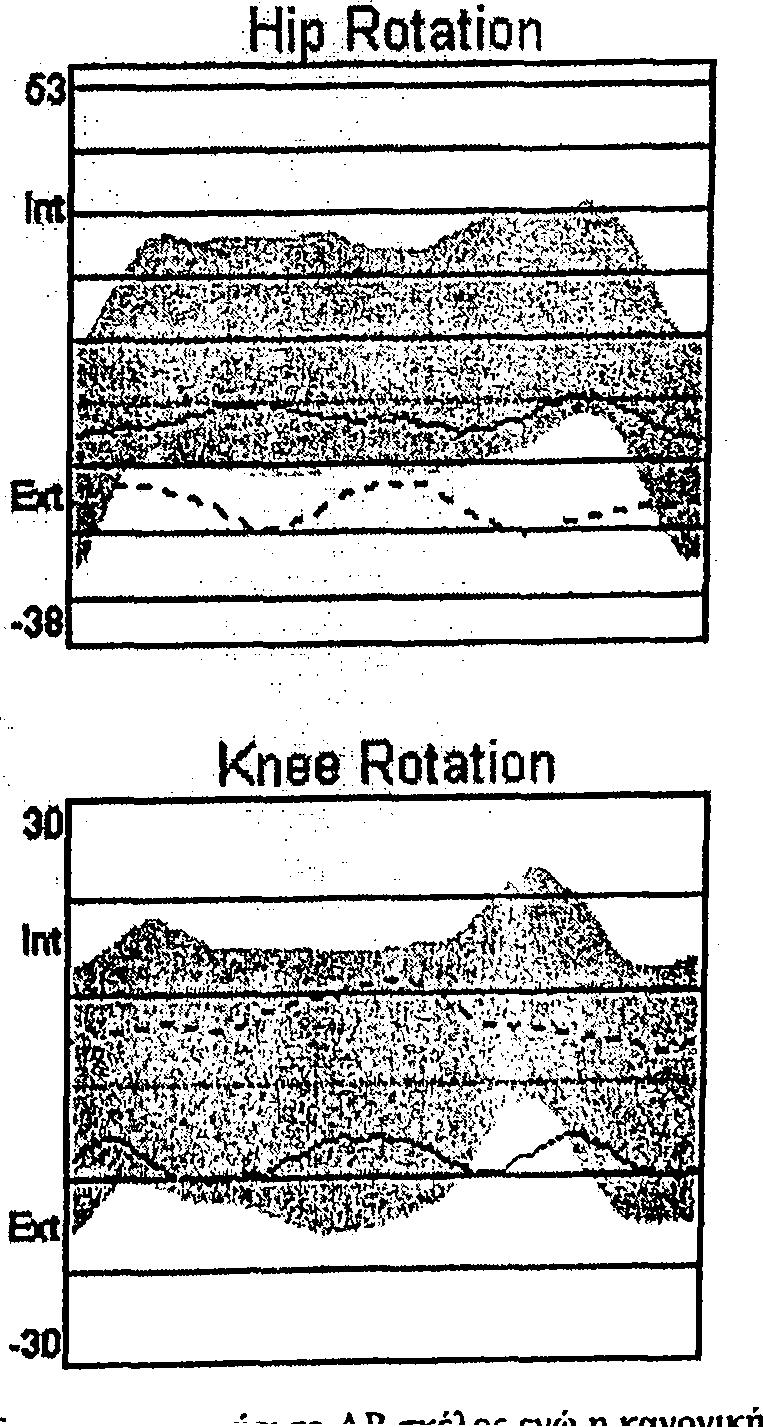 Flexion/Extension 80 M k Fl«x M m