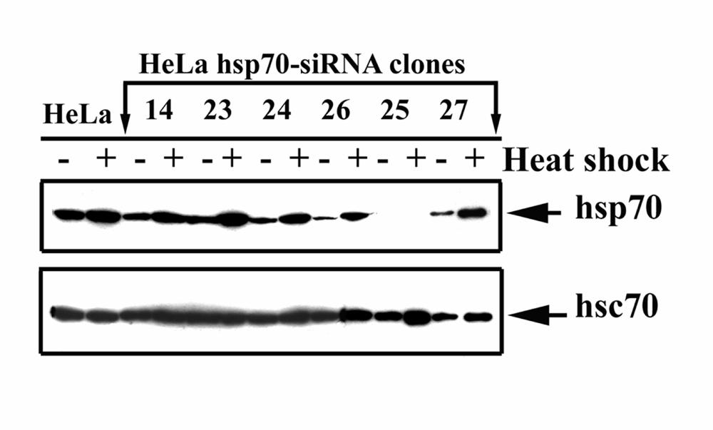\\\\\\\\\\\\ Εικόνα 17: Γονιδιακή αποσιώπηση της έκφρασης του γονιδίου Hsp70 (Heat Shock Protein 70) στα HeLa κύτταρα.