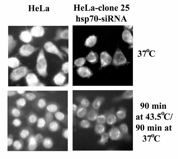(β) Ανοσοφθορισμός πατρικών HeLa και HeLa-siRNA-Hsp70 με την χρήση αντισωμάτων ειδικώνγια την ανίχνευση της Hsp70 (Angelidis et al