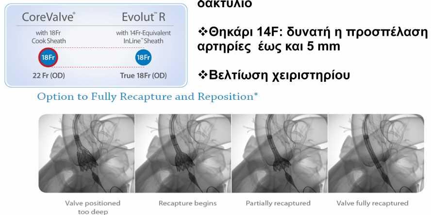 επαφή και προσαρμογή στο δακτύλιο Θηκάρι 14F: