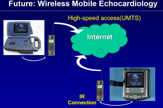 ECHO INFORMATION PROPAGATES