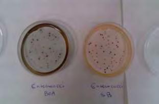 ροζ. Ακολουθούν επιβεβαιωτικές δοκιμασίες με την μεταφορά της μεμβράνης διήθησης σε τρυβλίο με Bile-esculine-azide agar και επώαση στους 44 ο C για 2 h.