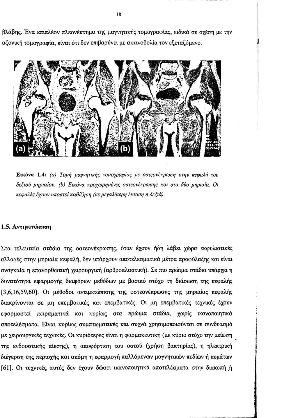 18 βλάβης. Ένα επιπλέον πλεονέκτημα της μαγνητικής τομογραφίας, ειδικά σε σχέση με την αξονική τομογραφία, είναι ότι δεν επιβαρύνει με ακτινοβολία τον εξεταζόμενο. Ε ικ ό ν α 1.