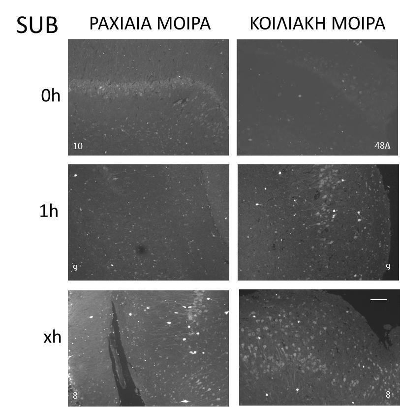 Εικόνα 18. Ανοσοϊστοχημικός εντοπισμός του GABA στo υπόθεμα (Sub) σε τομές ιπποκάμπου της ραχιαίας και κοιλιακής μοίρας μετά από 0h, 1h και xh παραμονής σε ΤΕΝΥ.