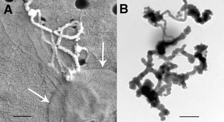 Vpliv hidrokoloida na osnovno tkanino ekosistema (A) Celica z mineraliziranimi filamenti in nemineraliziranimi fibrili (B) FeOOH-mineralizirani