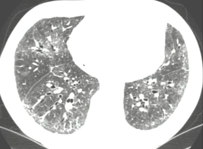 Specific CT