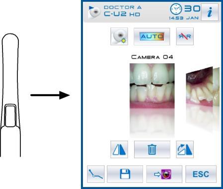 5.8. ΕΝΔΟΣΤΟΜΑΤΙΚΗ ΚΑΜΕΡΑ C-U2 Η C-U2 είναι μία κάμερα ενδοστοματική ειδικά σχεδιασμένη για απλή χρήση στην ενδοστοματική οδοντική εξέταση, με ένα χερόβολο άκρως ελαφρύς, αυτόματος έλεγχος έκθεσης