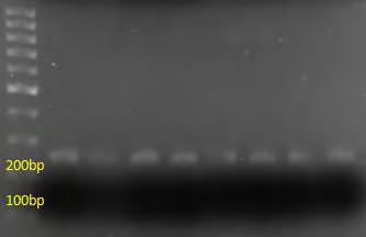 mir-29a και mir-1207. Τα επίπεδα πρωτεΐνης ελέγχθηκαν με ανοσοαποτύπωση (Western blot).
