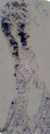(δ) Gills of mussels exposed to Hg and Cu mixture for 11 days showing extremely increased amount of BSD in the epithelial cells of the gill filament, in relation to