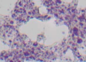 (ε-η) Ιστοχηµεία για το λυσοσωµικό ένζυµο Ν-ακετυλ-β-εξοζαµινιδάση σε κρυοτοµές του πεπτικού αδένα µυδιών M.