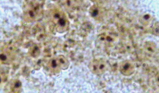 Histochemistry for the lysosomal enzymes N-acetyl-β-hexozaminidase, acid phosphatase and β- glucuronidase in the digestive gland cryosections of the small in size mussels M.