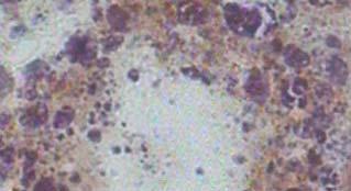 πεπτικών κυττάρων των µυδιών. α-γ: 1800 x, δ-στ: 4000x, L: αγωγός πεπτικού σωληναρίου Figure 33.