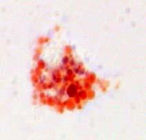 Φωτογραφίες αιµοκυττάρων από οπτικό µικροσκόπιο στις οποίες φαίνονται τα διάφορα στάδια των αιµοκυττάρων των µυδιών κατά την εφαρµογή της τεχνικής «κατακράτηση της χρωστικής ουδέτερο ερυθρό (NRR)».