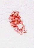 α) 1 st stage: the NR is retained in the small haemocyte lysosomes. β) 2 nd stage: the NR is still retained into the lysosomes, however signs of lysosomal enlargement are evidenced.