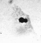 Φωτογραφίες από το οπτικό µικροσκόπιο στις οποίες φαίνονται µη κοκκώδη αιµοκύτταρα µυδιών M. galloprovincialis µε µικροπυρήνες και άλλες πυρηνικές ανωµαλίες.