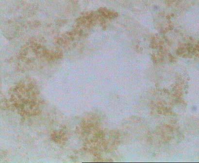 20γ) το περιεχόµενο των κυττάρων σε λιποφουσκίνη ήταν ιδιαίτερα αυξηµένο. α β γ L L L δ ε στ L L L Εικόνα 20. Ιστοχηµεία λιποφουσκινών σε κρυοτοµές του πεπτικού αδένα των µυδιών M. galloprovincialis.