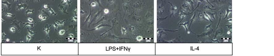 МФ третирани М1 стимулусима (LPS и IFNγ) имали су претежно заобљен облик, док су МФ третирани путем IL-4 (M2 стимулус) постали упадљиво издужени и вретенасти (Слика 4.13.