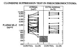 The clonidine suppresion test in pheochromokytoma E.T. Bravo.