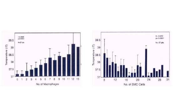Εικόνα 6: Ασθενείς με στένωση καρωτίδων: Σε δείγματα από αθηρεκτομή η θερμοκρασία συσχετίζεται με τον αριθμό των μακροφάγων και όχι των λείων μυικών κυττάρων. (Πηγή: Casscells et al Lancet 1996) 3.