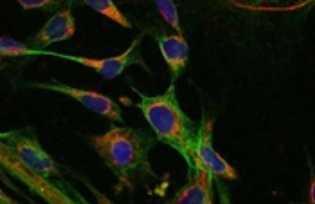 Φωτογραφία ανθρώπινων ινοβλαστών από αρχέγονα εμβρυονικά κύτταρα