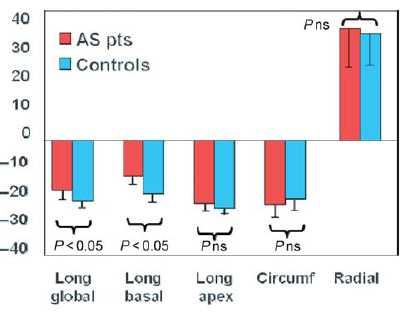 2D-ST στην ασυμπτωματική σοβαρή ΑΣ (n=65) με ΚΕ >55% GLS και 2D-strain στα βασικά