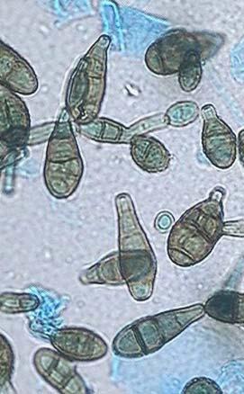 Alternaria spp