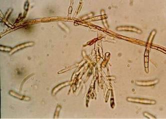 Fusarium spp