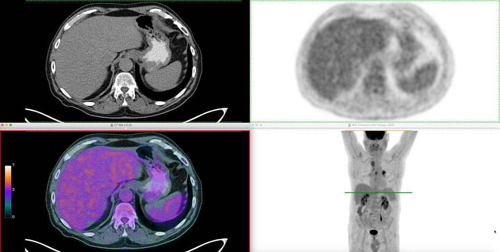 Display CT PET