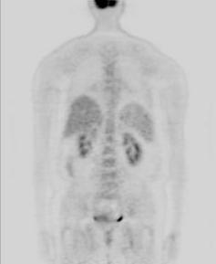 Body Scan